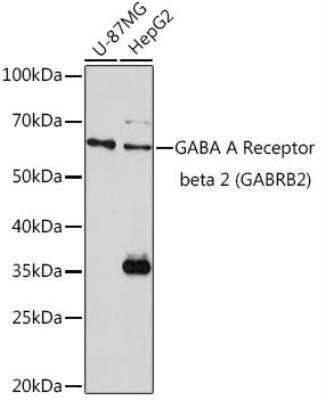 Western Blot: GABA-A R beta 2 AntibodyBSA Free [NBP3-03626]