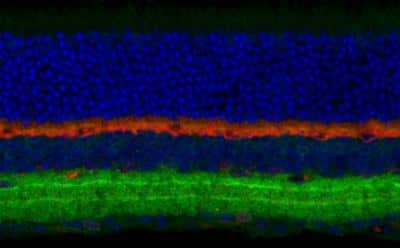 Immunohistochemistry: GABA-A R beta 3 Antibody [NB300-199]