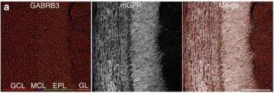 Immunohistochemistry-Frozen: GABA-A R beta 3 Antibody [NB300-199]