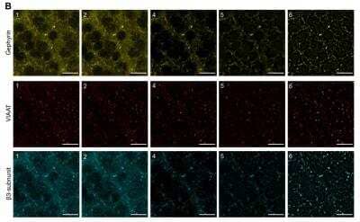 Immunohistochemistry: GABA-A R beta 3 Antibody [NB300-199]