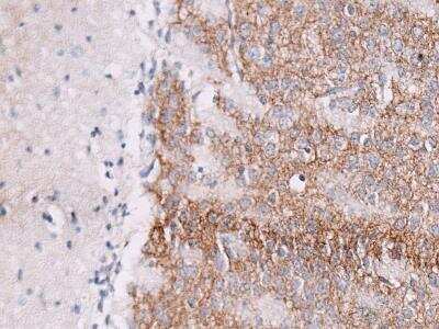 Immunohistochemistry-Paraffin: GABA-A R beta 3 Antibody [NB300-199]
