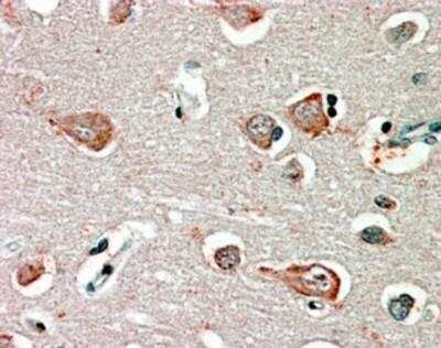 Immunohistochemistry-Paraffin: GABA-A R beta 3 Antibody [NBP1-06988]