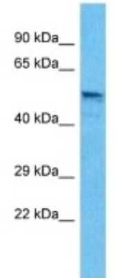 Western Blot: GABA-A R beta 3 Antibody [NBP3-10888]