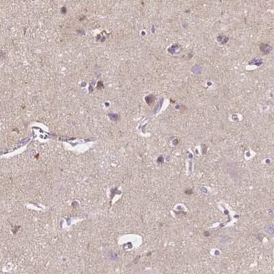 Immunohistochemistry-Paraffin: GABA-A R delta Antibody [NBP2-33421]