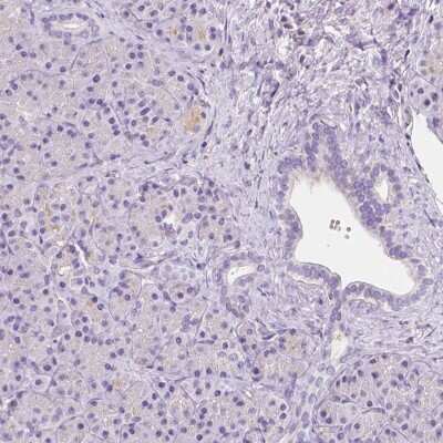 Immunohistochemistry-Paraffin: GABA-A R delta Antibody [NBP2-33421]