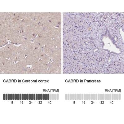 Immunohistochemistry-Paraffin: GABA-A R delta Antibody [NBP2-33421]