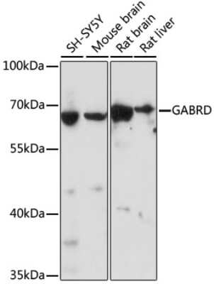 Western Blot: GABA-A R delta AntibodyAzide and BSA Free [NBP3-03679]