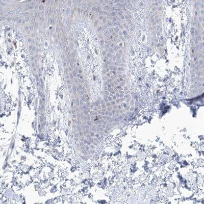 Immunohistochemistry-Paraffin: GABA-A R gamma 1 Antibody [NBP1-91003]