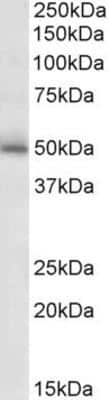 Western Blot: GABA-A R gamma 2 Antibody [NBP1-49868]