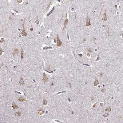 Immunohistochemistry-Paraffin: GABA-A R gamma 3 Antibody [NBP2-30464]