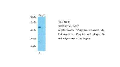 Western Blot: GABA-A R pi Antibody [NBP2-84036]