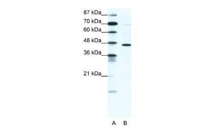 Western Blot: GABA-A R pi Antibody [NBP2-84037]