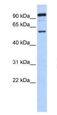 Western Blot: GABA-A R rho 1 Antibody [NBP1-80060]