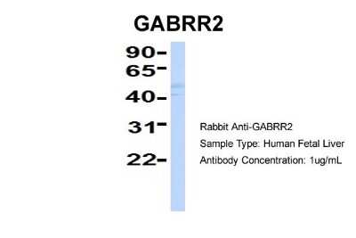 Western Blot: GABA-A R rho 2 Antibody [NBP1-80061]