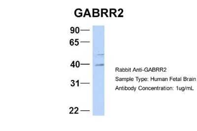 Western Blot: GABA-A R rho 2 Antibody [NBP1-80061]