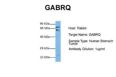 Western Blot: GABA-A R theta Antibody [NBP1-80078]