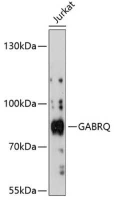 Western Blot: GABA-A R theta AntibodyAzide and BSA Free [NBP3-03689]