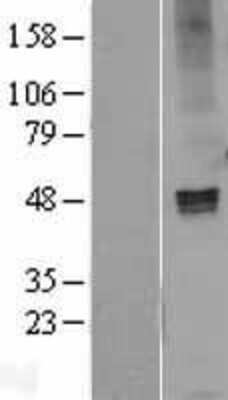 Western Blot: GABA-AR alpha 1 Overexpression Lysate [NBL1-10915]