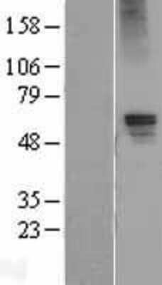 Western Blot: GABA-AR alpha 5 Overexpression Lysate [NBL1-10918]