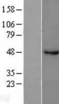 Western Blot: GABA-A R beta 1 Overexpression Lysate [NBL1-10920]