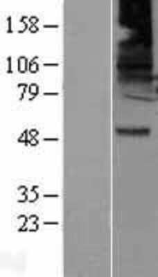 Western Blot: GABA-A R beta 2 Overexpression Lysate [NBL1-10921]