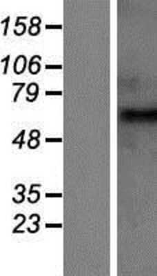 Western Blot: GABA-A R beta 2 Overexpression Lysate [NBP2-11262]