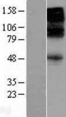 Western Blot: GABA-A R beta 3 Overexpression Lysate [NBL1-10922]