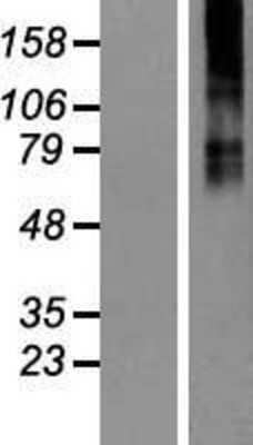 Western Blot: GABA-A R beta 3 Overexpression Lysate [NBP2-11263]