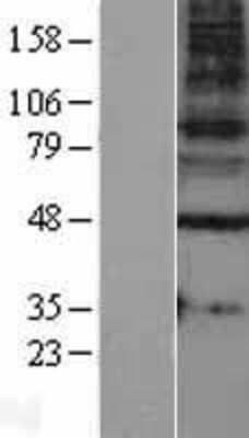 Western Blot: GABA-A R gamma 1 Overexpression Lysate [NBL1-10925]