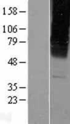 Western Blot: GABA-A R gamma 2 Overexpression Lysate [NBL1-10926]