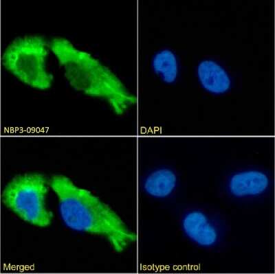 Immunocytochemistry/ Immunofluorescence: GABA-AR alpha 1 Antibody (1F4) - Chimeric - Azide and BSA Free [NBP3-09047]