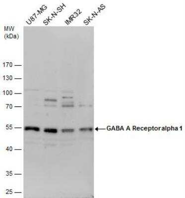 Western Blot: GABA-AR alpha 1 Antibody [NBP2-16565]