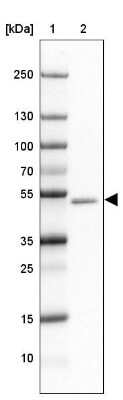 Western Blot: GABA-AR alpha 1 Antibody [NBP2-33762]