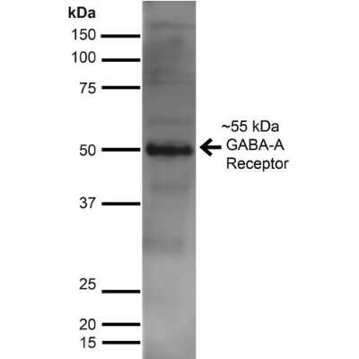 Western Blot: GABA-AR alpha 2 Antibody (S399-19) [NBP2-59325]