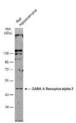 Western Blot: GABA-AR alpha 2 Antibody [NBP2-16566]