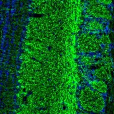 Immunohistochemistry: GABA-AR alpha 3 Antibody [NBP1-87499]