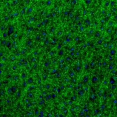 Immunohistochemistry: GABA-AR alpha 3 Antibody [NBP1-87499]