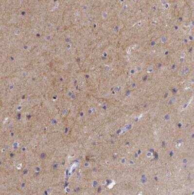 Immunohistochemistry-Paraffin: GABA-AR alpha 3 Antibody [NBP1-87499]