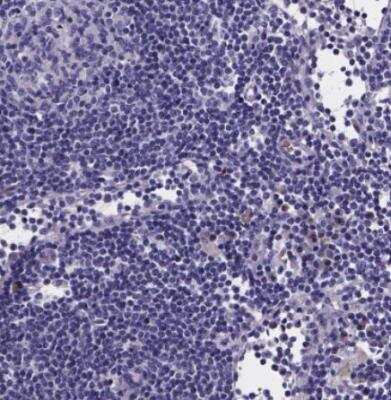 Immunohistochemistry-Paraffin: GABA-AR alpha 3 Antibody [NBP1-87499]