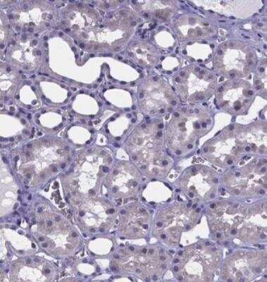 Immunohistochemistry-Paraffin: GABA-AR alpha 3 Antibody [NBP1-87499]