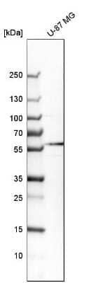 Western Blot: GABA-AR alpha 3 Antibody [NBP1-87499]