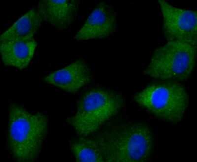 Immunocytochemistry/ Immunofluorescence: GABA-AR alpha 5 Antibody (JB34-19) [NBP2-75497]