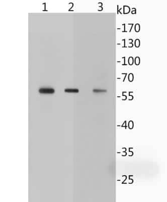 Western Blot: GABA-AR alpha 5 Antibody (JB34-19) [NBP2-75497]