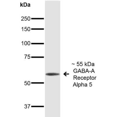 Western Blot: GABA-AR alpha 5 Antibody (S415-24) [NBP2-59700]