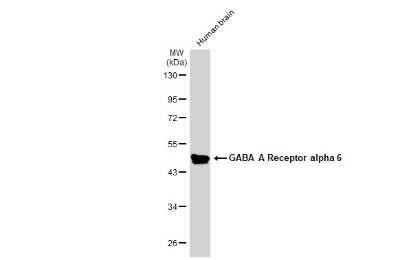 Western Blot: GABA-AR alpha 6 Antibody [NBP3-12973]