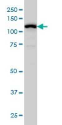 Western Blot: GABA-B R1 Antibody (2D7) [H00002550-M01]