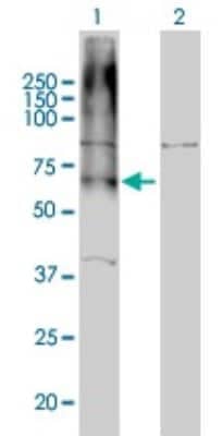 Western Blot: GABA-B R1 Antibody (2D7) [H00002550-M01]