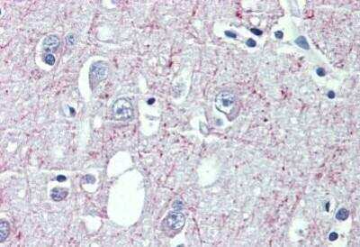 Immunohistochemistry-Paraffin: GABA-B R1 Antibody [NBP1-52389]