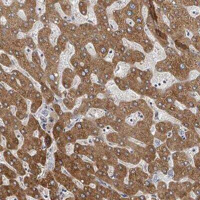 Immunohistochemistry-Paraffin: GABA-B R1 Antibody [NBP2-14033]