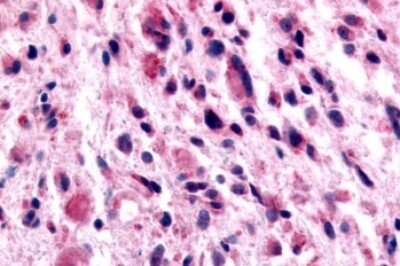 Immunohistochemistry-Paraffin: GABA-B R1 Antibody - BSA Free [NLS5332]